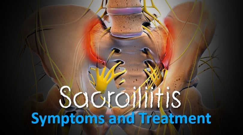 Sacroiliitis Treatments - What Is Sacroiliitis And Symptoms